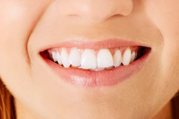 Dientes de mujer sanos y sonreír. Aislado sobre blanco . — Foto de Stock