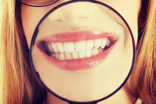 Close up on females teeth — Stock Photo, Image