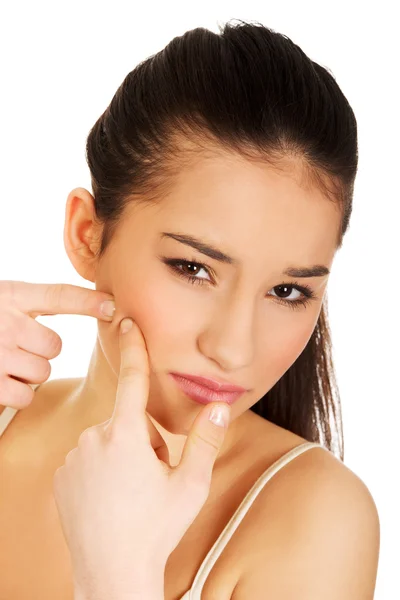 Teenage woman squeezing pimple. — Stock Photo, Image