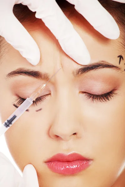 Iniezione di botox cosmetico — Foto Stock