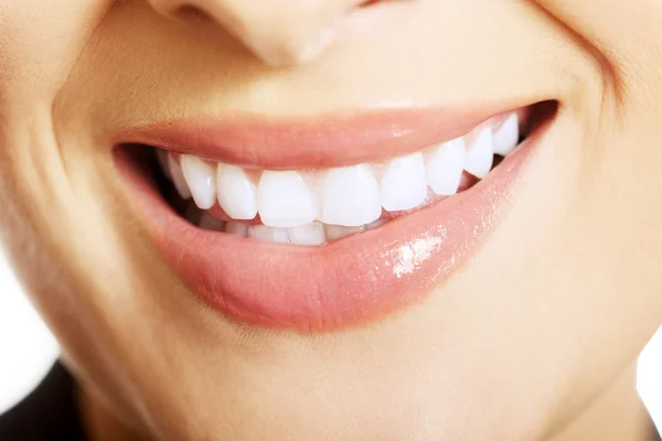 Cerca de la mujer dientes blancos — Foto de Stock