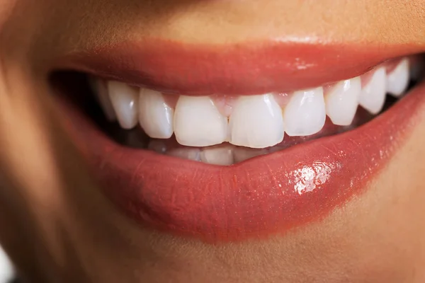 Close up on woman white teeth — Stock Photo, Image