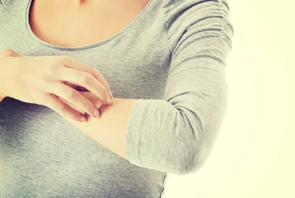 Woman is scratching herself on arm. — Stock Photo, Image