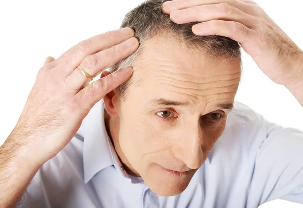 Homem examinando seu cabelo — Fotografia de Stock