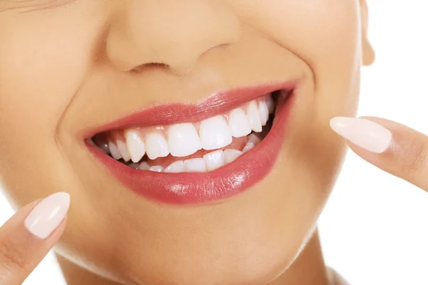 Beautiful woman pointing to teeth. — Stock Photo, Image