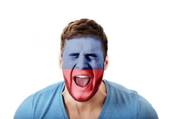 Křičící muž s příznakem Lichtenstein na obličej. — Stock fotografie