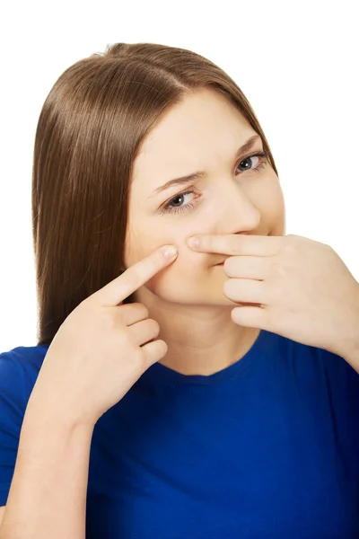 Jonge vrouw persen puistje. — Stockfoto