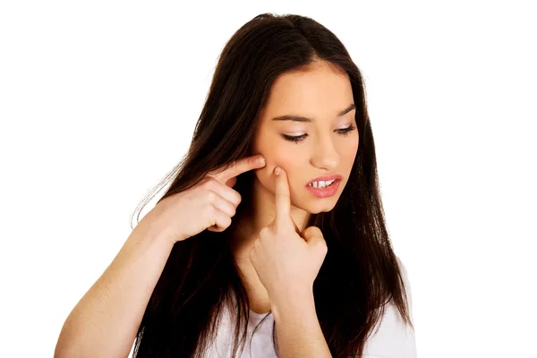 Teenage woman squeezing pimple. — Stock Photo, Image