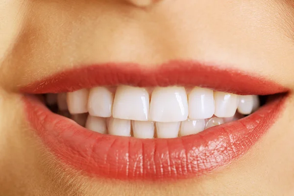 Womans white teeth — Stock Photo, Image