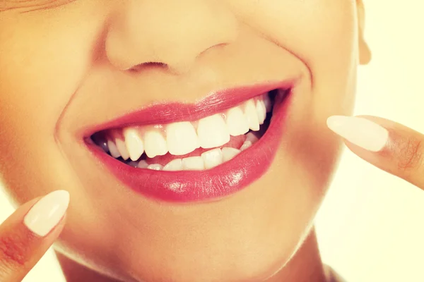 Schöne Frau zeigt auf Zähne. — Stockfoto