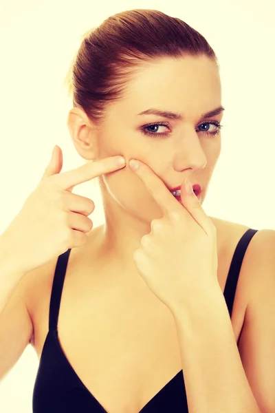 Young woman squeezes her acne. — Stock Photo, Image