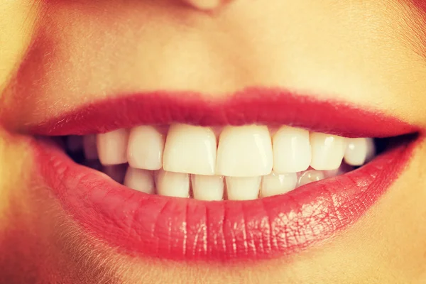 여 대 흰 치아 — 스톡 사진