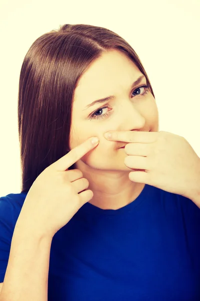 Young woman squeezing pimple. — Stock Photo, Image
