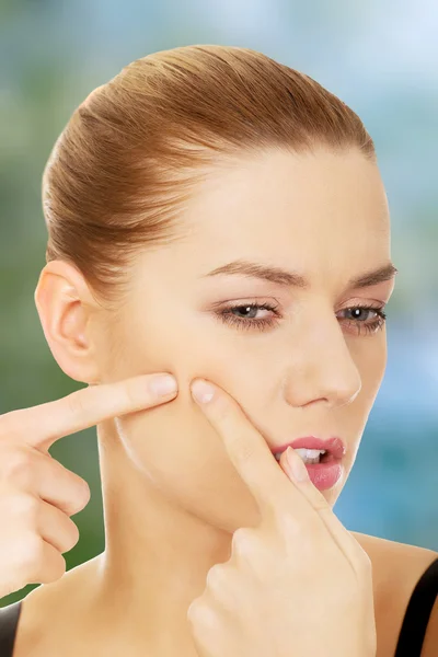 Mujer joven aprieta su acné . —  Fotos de Stock