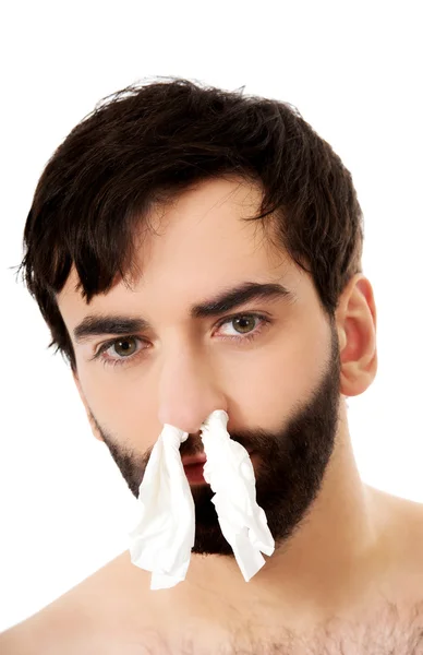 Hombre enfermo con tejidos en la nariz . —  Fotos de Stock