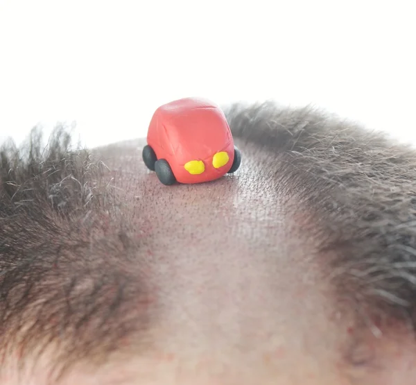 Conceptual image of alternative road for cars on man's head — Stock Photo, Image