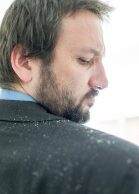 Kepek saç diplerinden sahip bir adam
