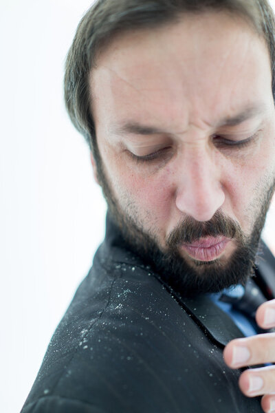 Мужчина с перхоти в волосах
