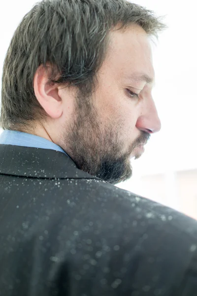 Um homem com caspa no cabelo — Fotografia de Stock