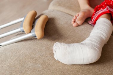 Alçılı ve koltuk değnekli genç bir kızda bilek kemikleri kırılmış.