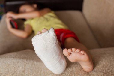 Alçılı bir genç kızın yaralı bacağı evdeki kanepede uzanıyor ve oynuyor ya da cep telefonundan bir şeyler izliyor.