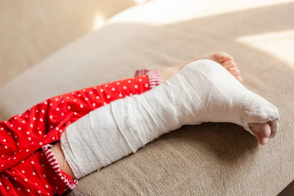 Τραυματισμένο πόδι αγνώριστου κοριτσιού σε γύψο ξαπλωμένο στον καναπέ στο σπίτι — Φωτογραφία Αρχείου