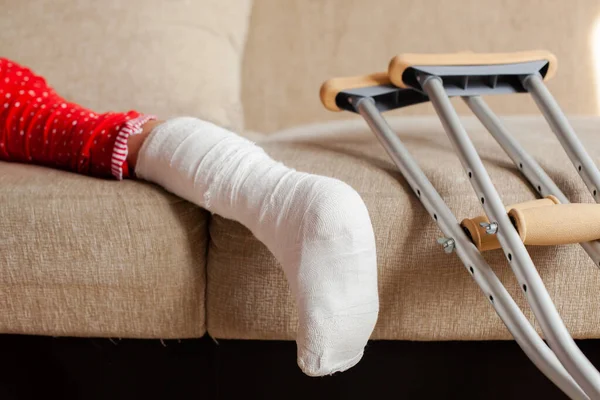 Bruch der Knöchelknochen bei einer Patientin im Teenageralter mit Gips und Krücken — Stockfoto