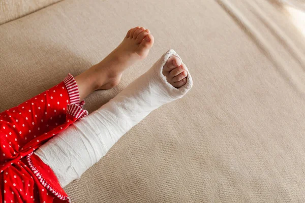 Beinverletzung eines nicht wiederzuerkennenden Mädchens in einem Gips, das zu Hause auf dem Sofa liegt — Stockfoto