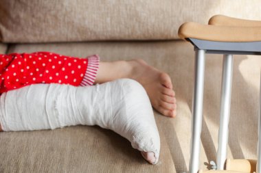 Alçılı ve koltuk değnekli genç bir kızda bilek kemikleri kırılmış. Cerrahi rehabilitasyon ve ortopedik iyileşme, kanepede yatmak, evde kalmak.