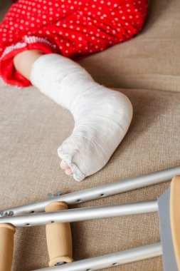 Alçılı ve koltuk değnekli genç bir kızda bilek kemikleri kırılmış. Cerrahi rehabilitasyon ve ortopedik iyileşme, kanepede yatmak, evde kalmak.