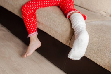 Ayak bileği kırıldıktan sonra kanepede düşen genç bir kızın bacağı alçıdaydı.