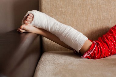 Ayak bileği kırıldıktan sonra kanepede düşen genç bir kızın bacağı alçıdaydı.