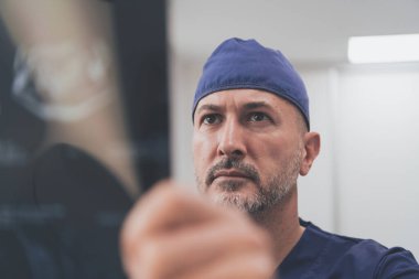 Hastanedeki ya da klinikteki ortopedist doktor röntgen filmini inceliyor. Yüksek kalite fotoğraf. Seçici odak