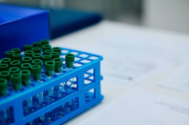 Yeşil başlıklı temiz test tüpleri bir laboratuvar masasında mavi bir askıda düzenlenir. Kağıtlar ve belgeler dağılmış vaziyette, tesiste devam eden bilimsel çalışmaları gösteriyor..