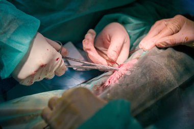 Cerrahi bir ekip ameliyat sırasında pensleri dikiş dikmek ve parçalamak için kullanır. Eldivenli eller, hasta ensizyonuna özen gösterilirken aletlere rehberlik eder. Görüntü odak, steril ortam ve