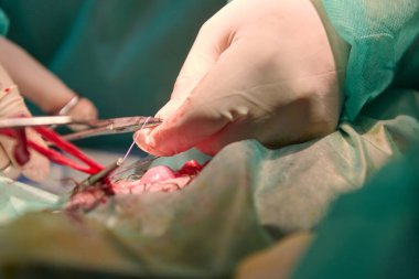 Eldivenli tıp uzmanları steril bir ameliyathanede neşter ve dikişler kullanarak, odaklanma, takım çalışması ve yüksek bahisli bakımı kullanarak hassas bir operasyon gerçekleştiriyorlar..