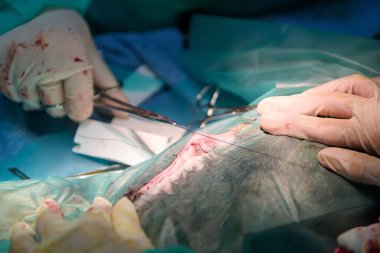 Cerrahlardan oluşan bir tıbbi ekip ameliyathanede steril aletler ve dikişler kullanarak hassas bir ameliyat gerçekleştirir. Odaklanma, bakım ve profesyonel tıbbi ekip çalışması sağlanır..