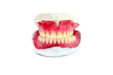 teeth mold clipart