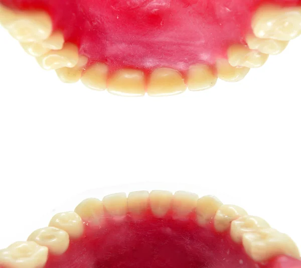 Форма зубов — стоковое фото