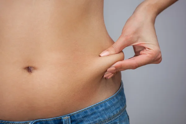 腹部や側面に脂肪を示す手の皮膚を引っ張ります。過剰体重の治療と処分,皮下脂肪組織の沈着. — ストック写真