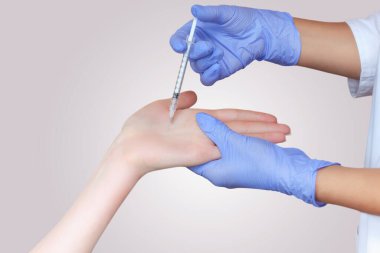 Doktor hiperhidroza karşı kadının avuçlarında kas içi botulinyum iğnesi yapıyor..