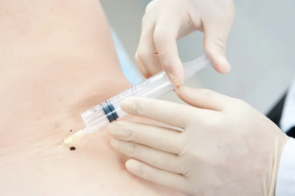 The doctor puts the patient vaccinated — Stock Photo, Image