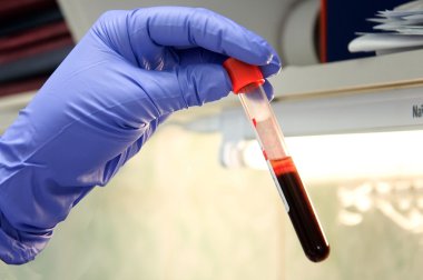 El ile test tüpü laboratuvar