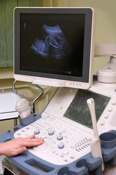 Orvosi vizsgálata terhes hasa által egy baba ultrahangos vizsgálata — Stock Fotó