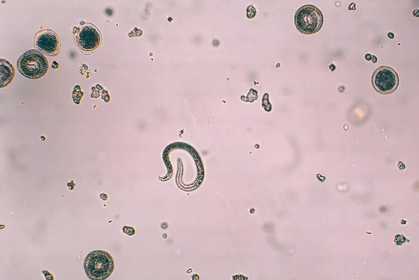 Toxocara canis y huevo embrionado con larva —  Fotos de Stock