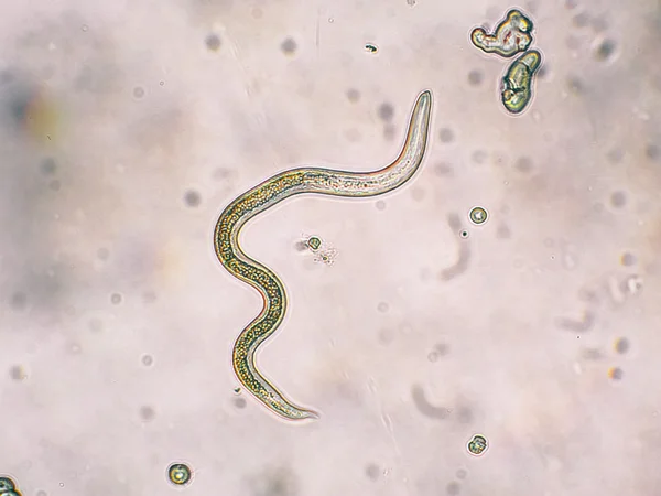 Toxocara canis 두번째 계란에서 무대 애벌레 해치 — 스톡 사진