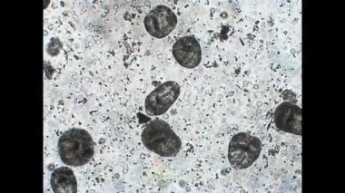 protoscoleces in parazitik kurt Ekinococozis multilocularis mikroskobik video katlanmış