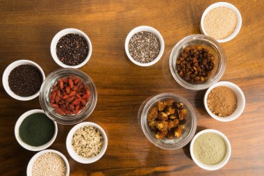 Bir sürü abur cubur.