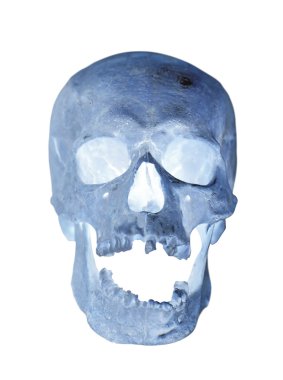 İnsan kafatası izole x-ray