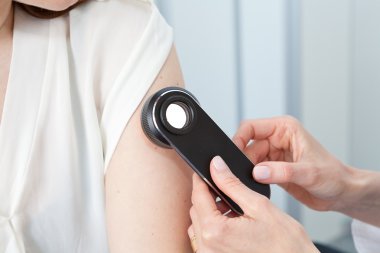 Doktor doğum lekeleri ve mol Bayan hasta üzerinde incelenmesi